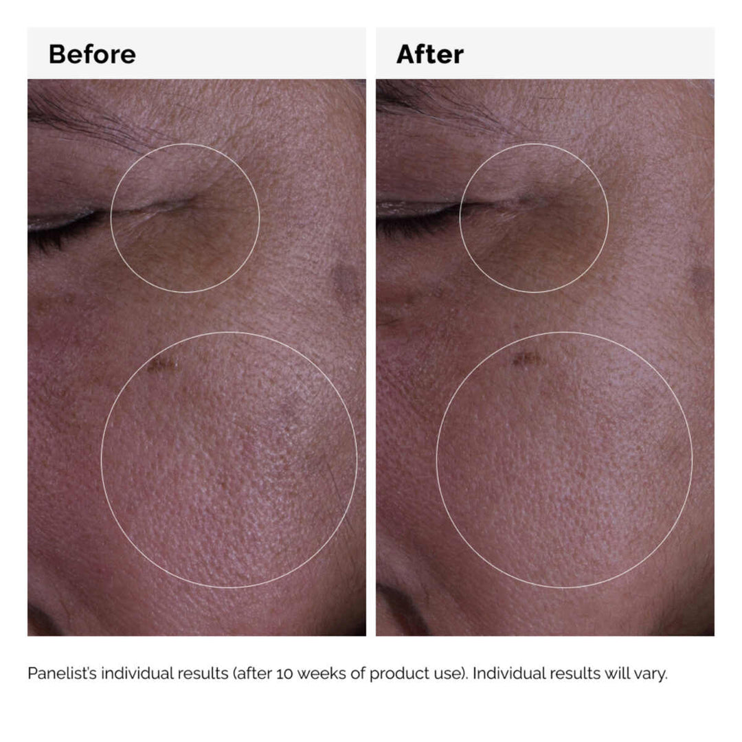 The Ordinary GF Solution 15% Serum Anti-Aging Treatment 30ml